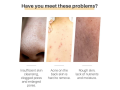savon-a-base-de-curcuma-et-dacide-kojic-small-1
